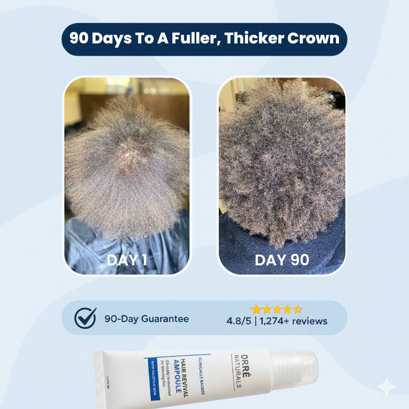 OrovaNaturals™ Hair Growth Essentials (2 Ampoules + 1 Serum)